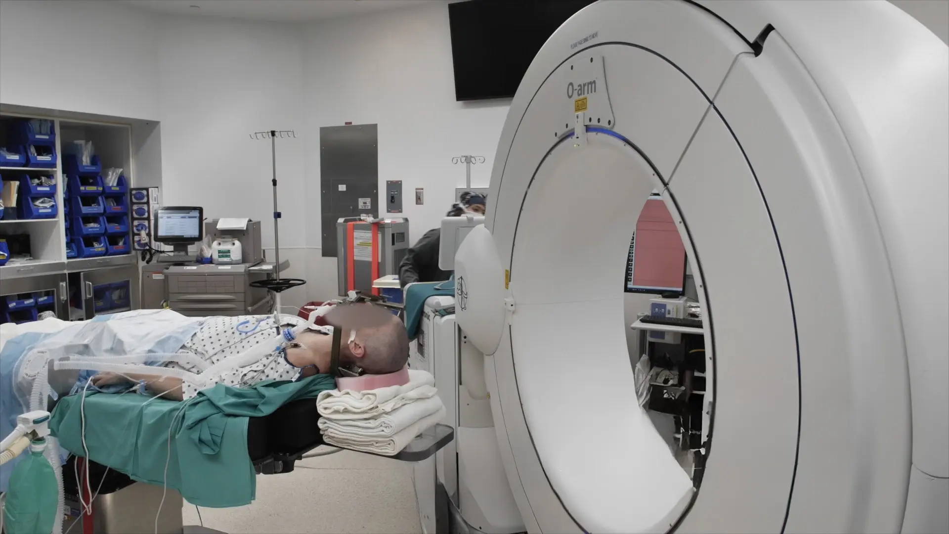 Robotic-Guided Stereoelectroencephalography for Invasive Epilepsy Monitoring