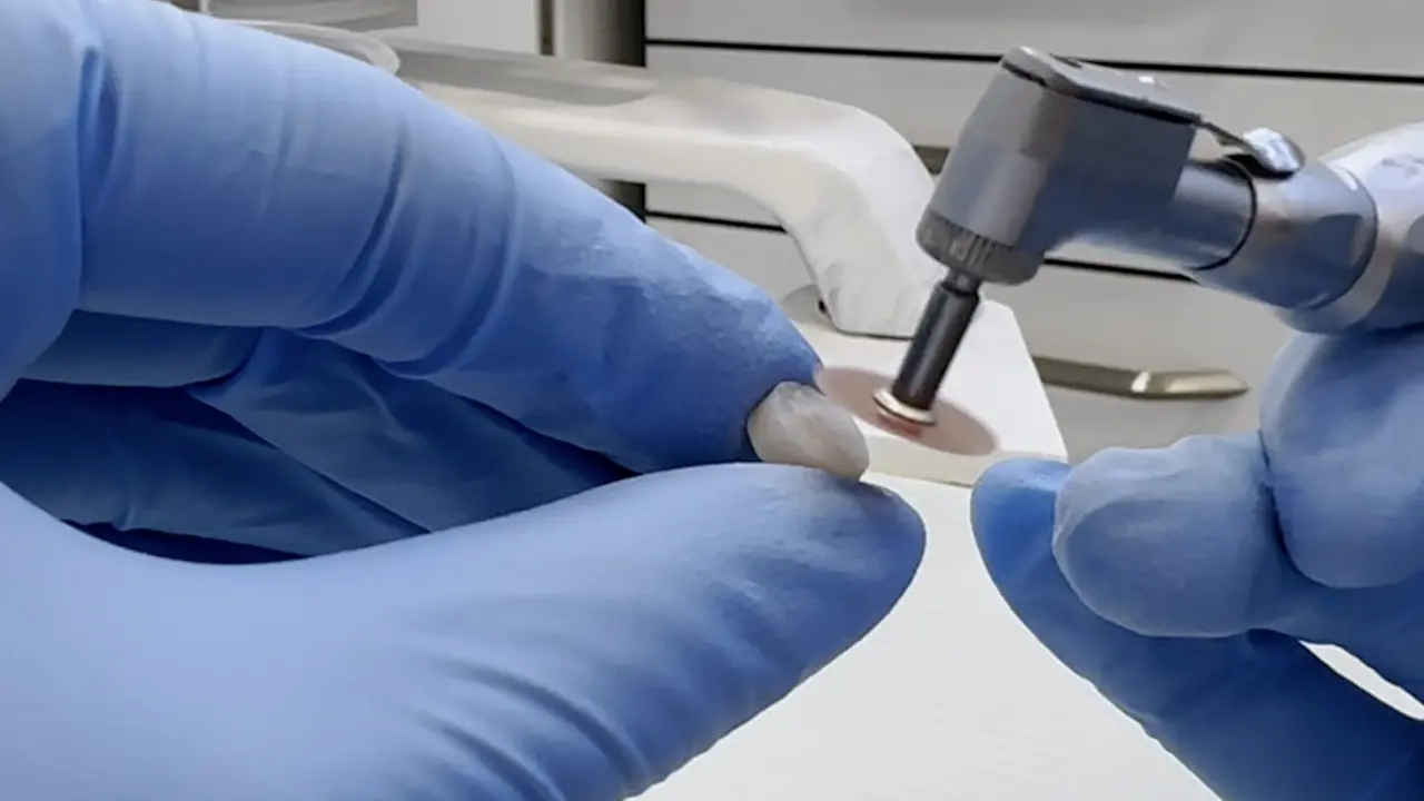 Evaluating the Effects of Different Polishing Methods on Color Stability of Dental Restorations in Pediatric Dentistry