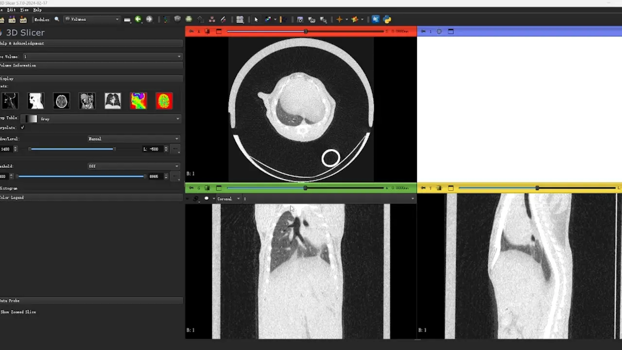 Unilateral Lung Volume Analysis Using Micro-CT for Enhanced Assessment of Pulmonary Fibrosis in Preclinical Models