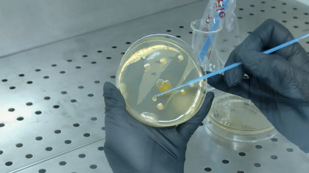 Isolation and Identification of Bacterial Strains from Skin of Terrestrial Amphibians