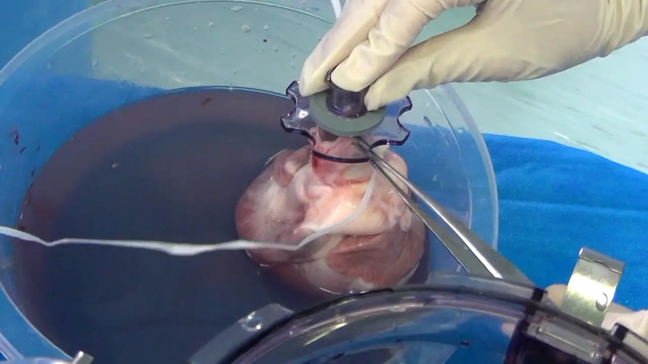 Innovative Strategies for Organ Preservation in Heart Transplantation: Uniform Cooling Preservation and <em>Ex-situ</em> Normothermic Perfusion