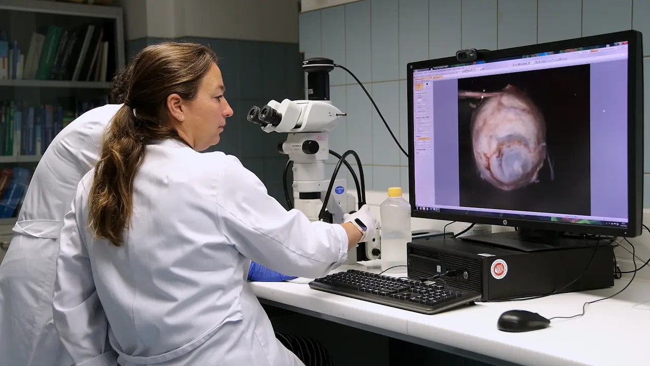 Grossing of Non-neoplastic Globes, Including Fetal Eyes