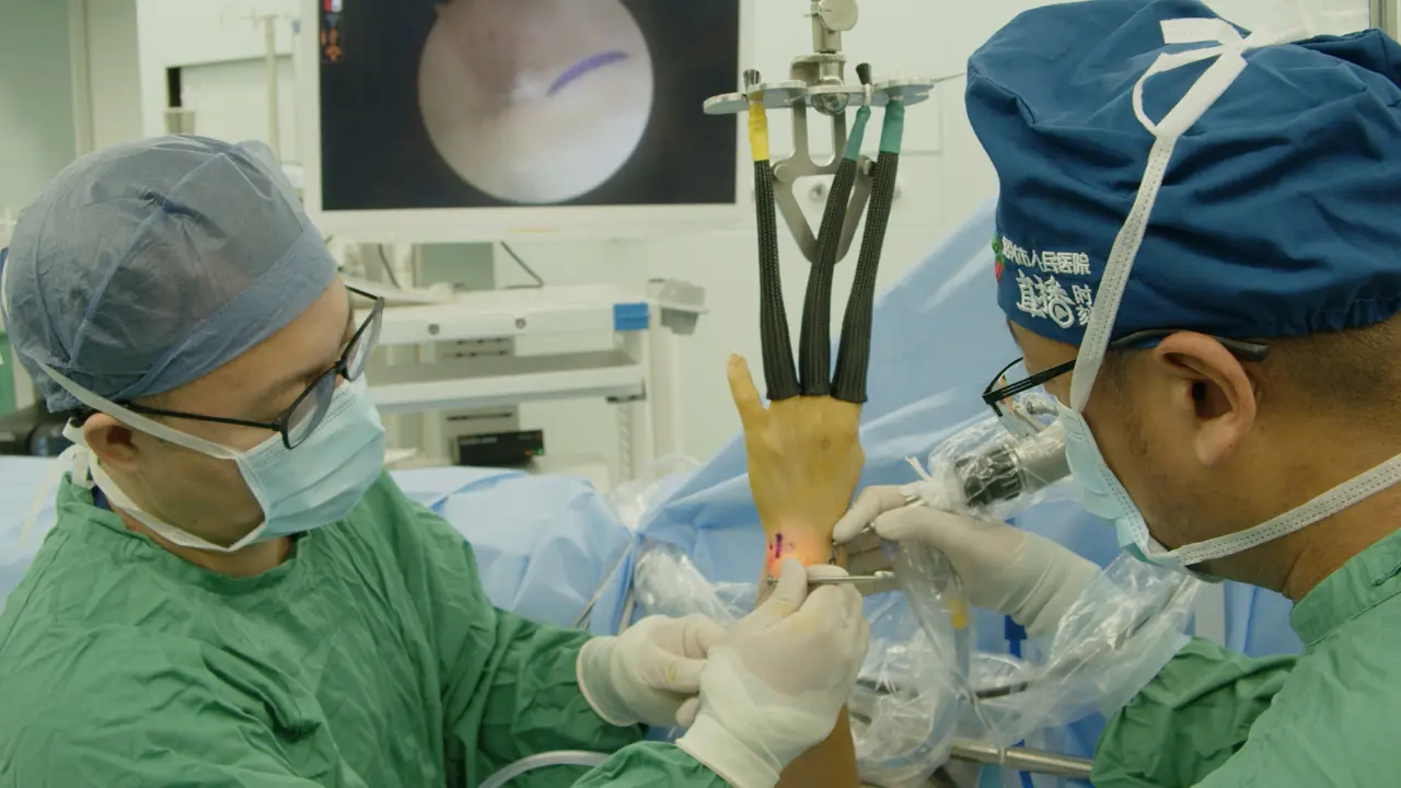 Novel Triple-Loop Technique for Suturing TFCC Injuries without Transosseous Tunnel