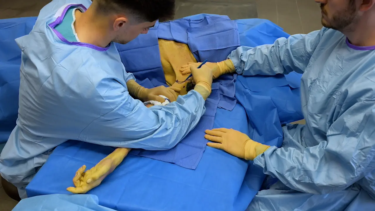 Vascularized Composite Upper Limb Allograft Harvesting for Proximal Arm Allotransplantation