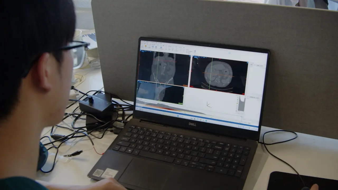 Utilizing a 3D Printed Laparoscopic Nissen Fundoplication Model to Shorten a Resident's Learning Curve
