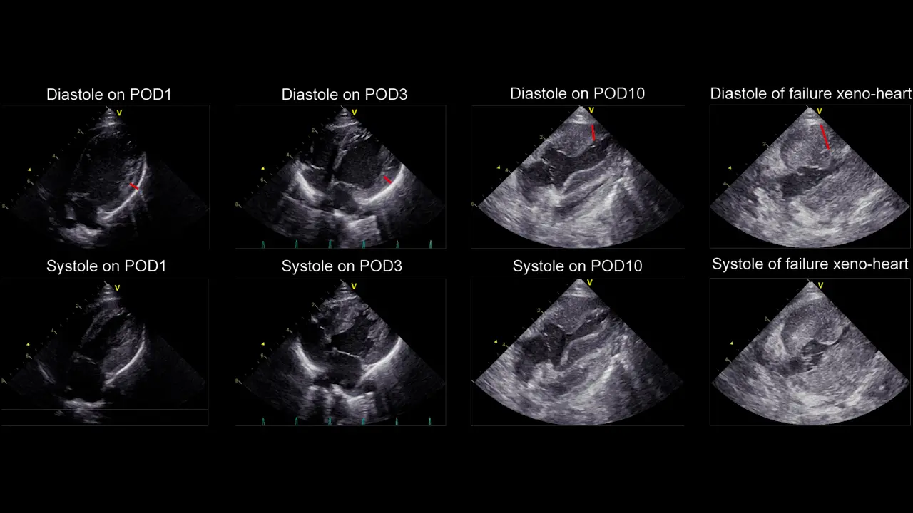 A Standardized Pig to Macaque Heterotopic Heart Xenotransplantation Model