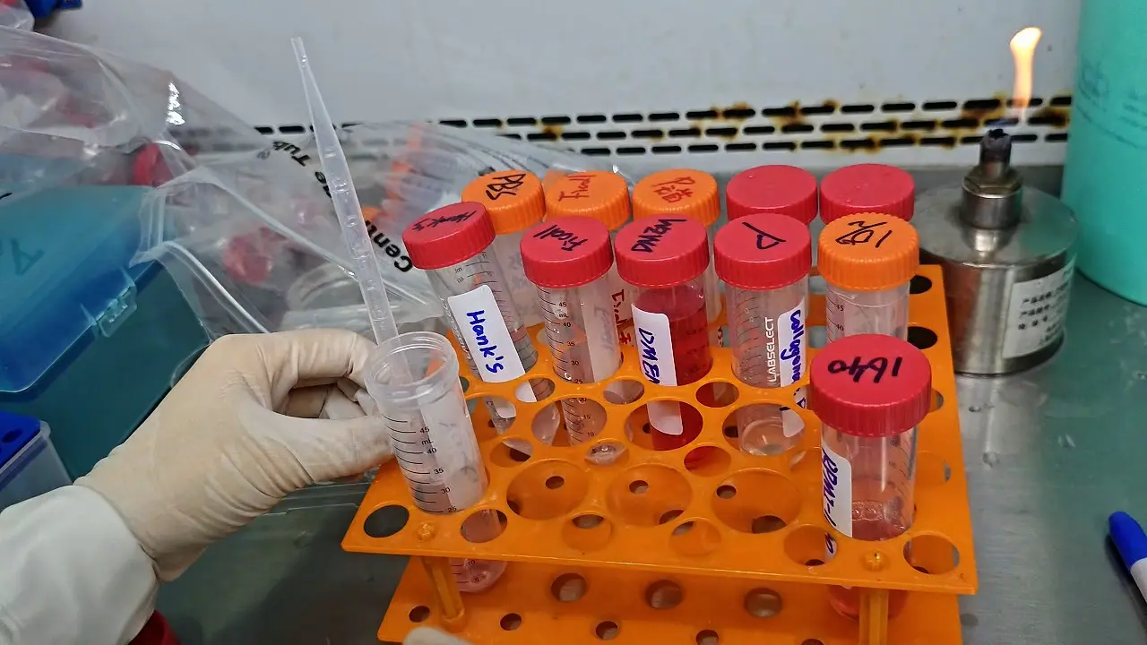 A Simple and Rapid Method for Simultaneous Isolation of Primary Islets and Primary Pancreatic Acinar Cells from Mice