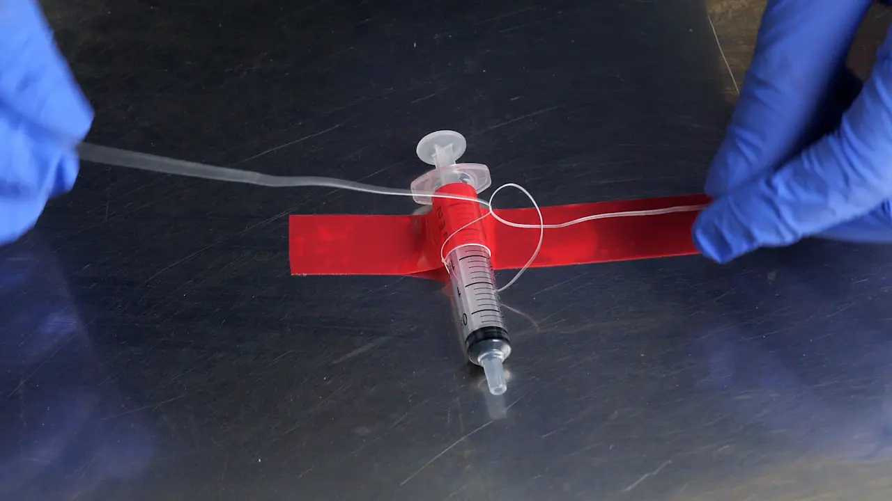 Self-Made Internal Traction Method For Endoscopic Submucosal Dissection of Early Gastric Cancer
