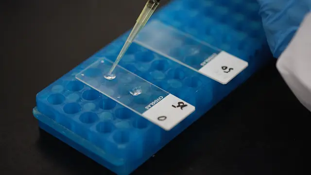 Nachweis der globalen DNA-Methylierung in den Herzen von Zebrafischlarven
