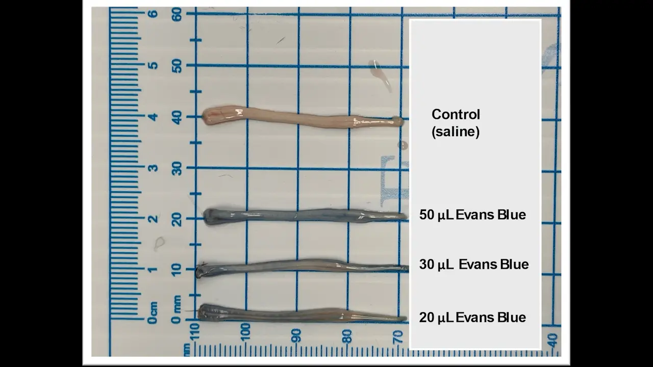 Lumbar Intrathecal Injection of SOD1-ASOs for Precise CNS Targeting and Predictive Efficacy in Human SOD1-G93A ALS Mice