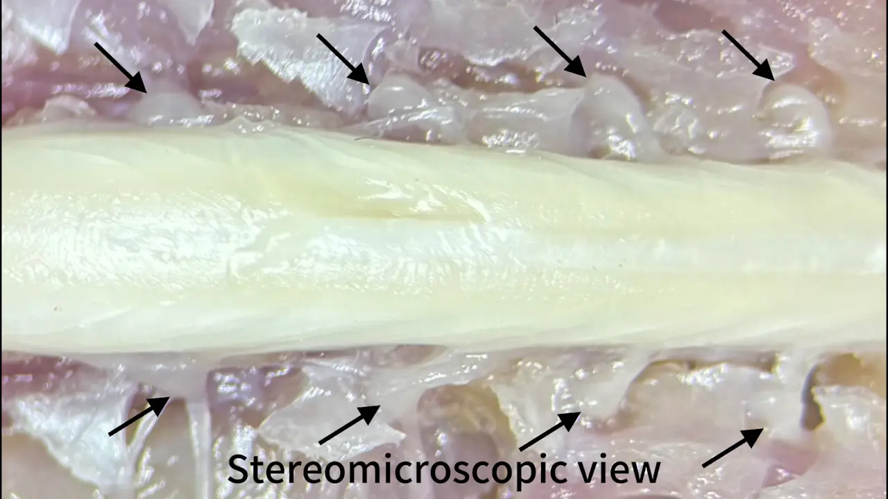 Dissection and Isolation of Mouse Dorsal Root Ganglia