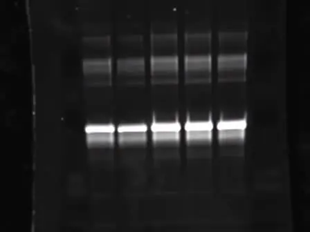Electrophoretic Separation of Proteins