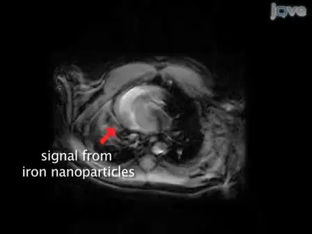 In vitro Labeling of Human Embryonic Stem Cells for Magnetic Resonance Imaging