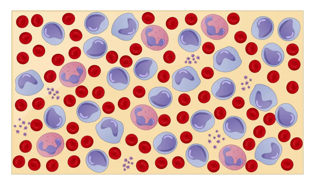 Leukemia