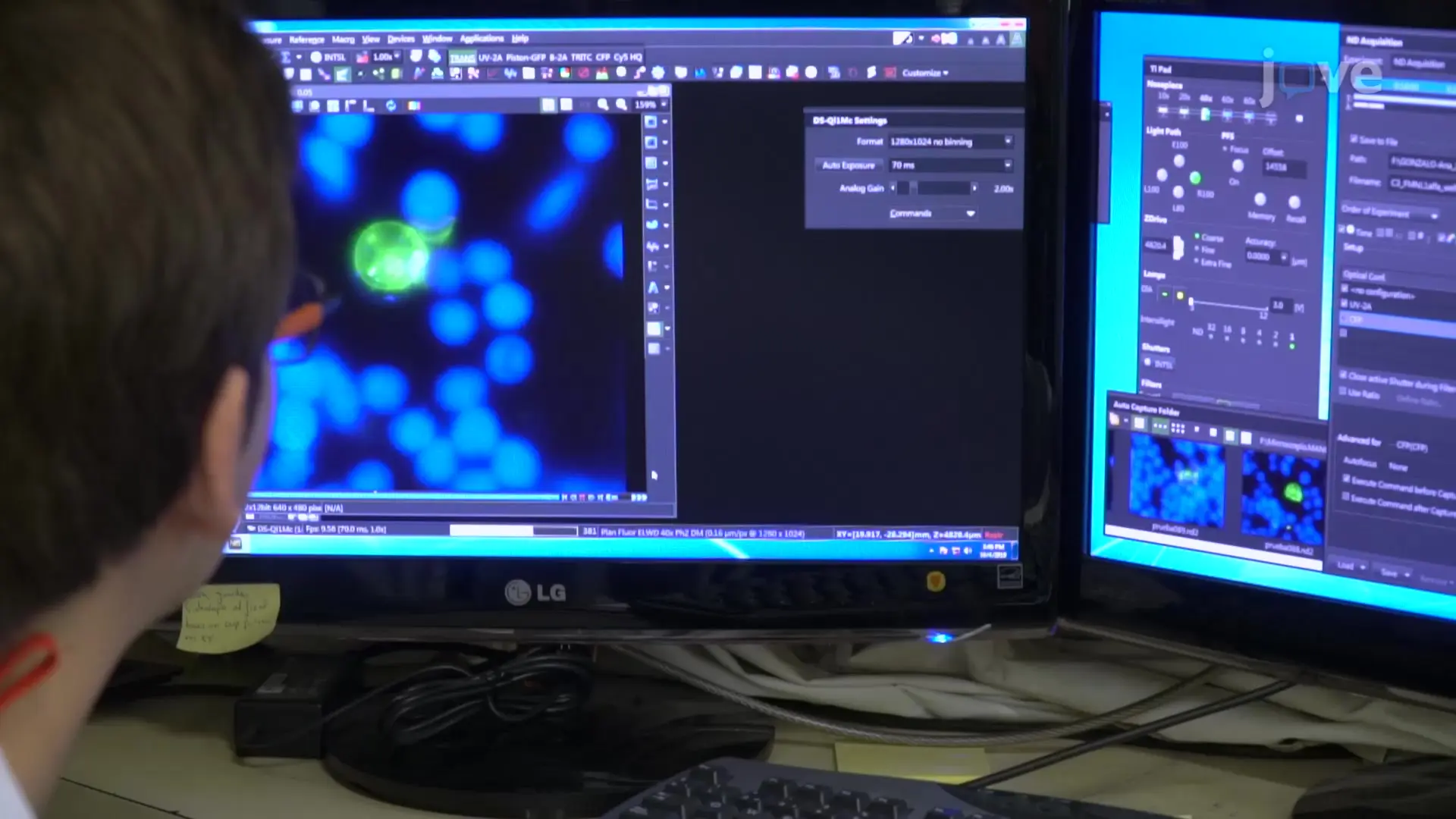 Immunology