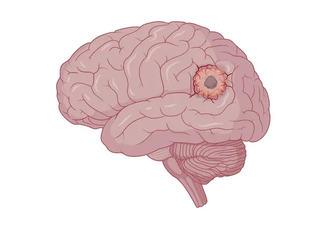 Collection-image
