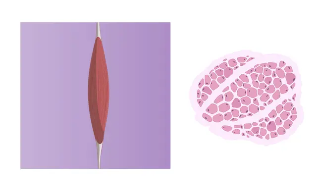 Collection-image