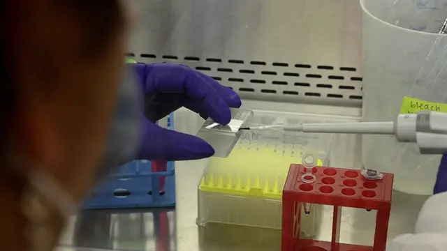 Rapid Optimization of a Light-Inducible System to Control Mammalian Gene Expression