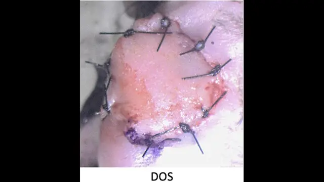 Heterotopic Hindlimb-to-Neck Transplantation in the Mouse: A Supermicrosurgical Model of Vascularized Composite Allotransplantation