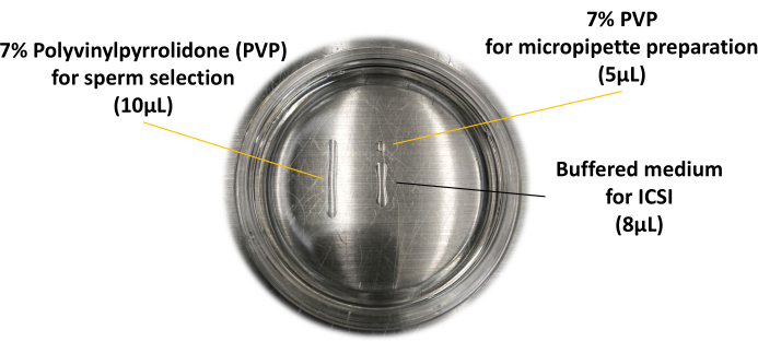 figure-results-1 ICSI setup with PVP for sperm selection and microliter measurements in a petri dish diagram.