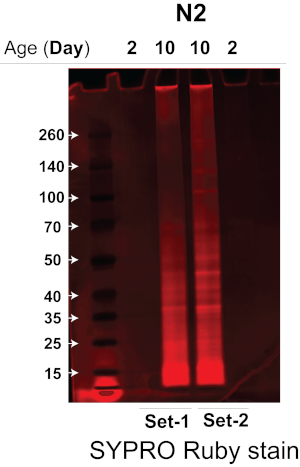 Protein electrophoresis results, SYPRO Ruby stain; gel bands show different protein ages in days.