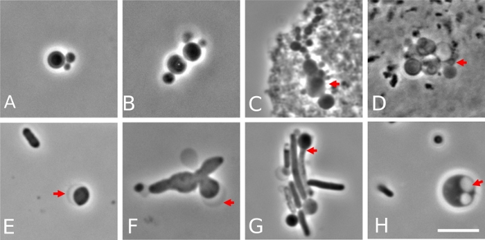 Microscopy images of bacterial cell aggregation, experimental analysis of cell interactions, diagram.