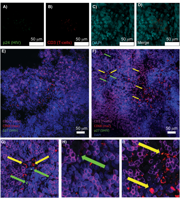figure-results-5 Fluorescence microscopy of HIV p24, CD3 T-cells; macrophage interaction, SHIV-infected tissue.