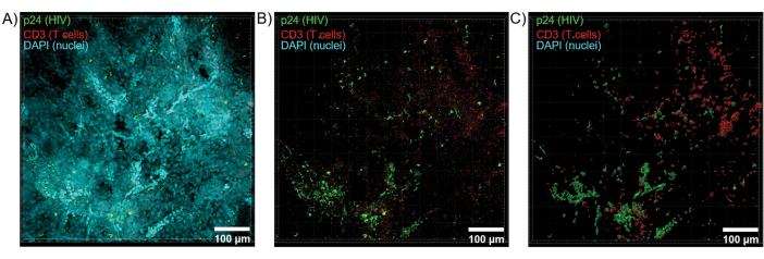 figure-results-6 HIV p24, CD3, DAPI fluorescence microscopy images; T cells, nuclei visualization; 100 µm scale.