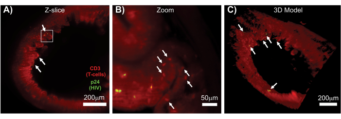 figure-results-7 HIV detection in CD3 T-cells; microscopy images; Z-slice, zoom, 3D model analysis.