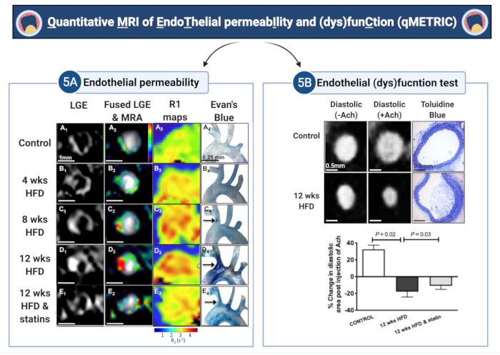 Quantitative MRI diagram of endothelial permeability, dysfunction test; analysis of HFD effects.