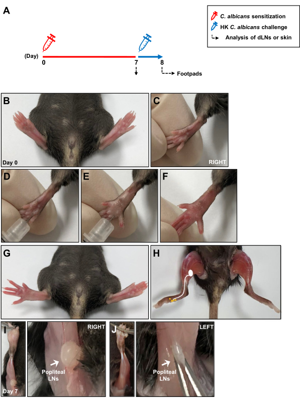 figure-protocol-1 C. albicans experiment diagram; sensitization, challenge, footpad analysis, popliteal LN examination.
