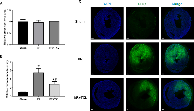 Bar graphs and microscopy images display relative cross-sectional area and fluorescence in Sham, I/R, I/R+TXL.