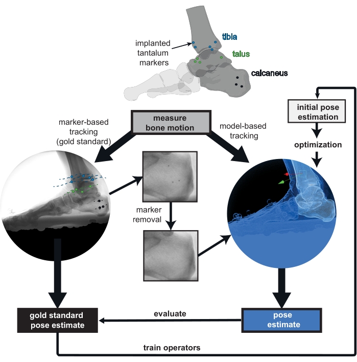 figure-introduction-1 Bone motion tracking diagram; marker-based vs. model-based methods; pose estimation process.