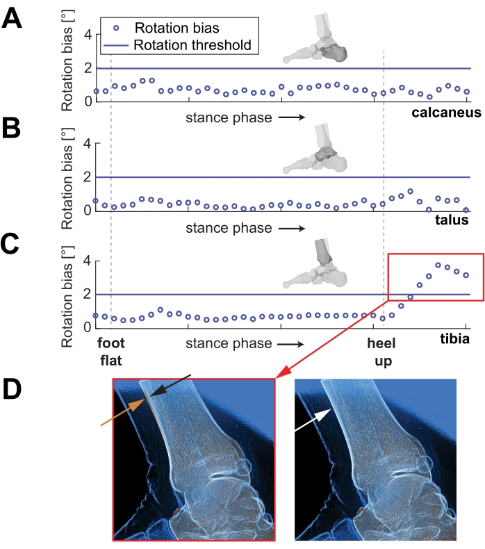 figure-results-2 Rotation bias during stance phase; graph and X-ray analysis of ankle bones: calcaneus, talus, tibia.