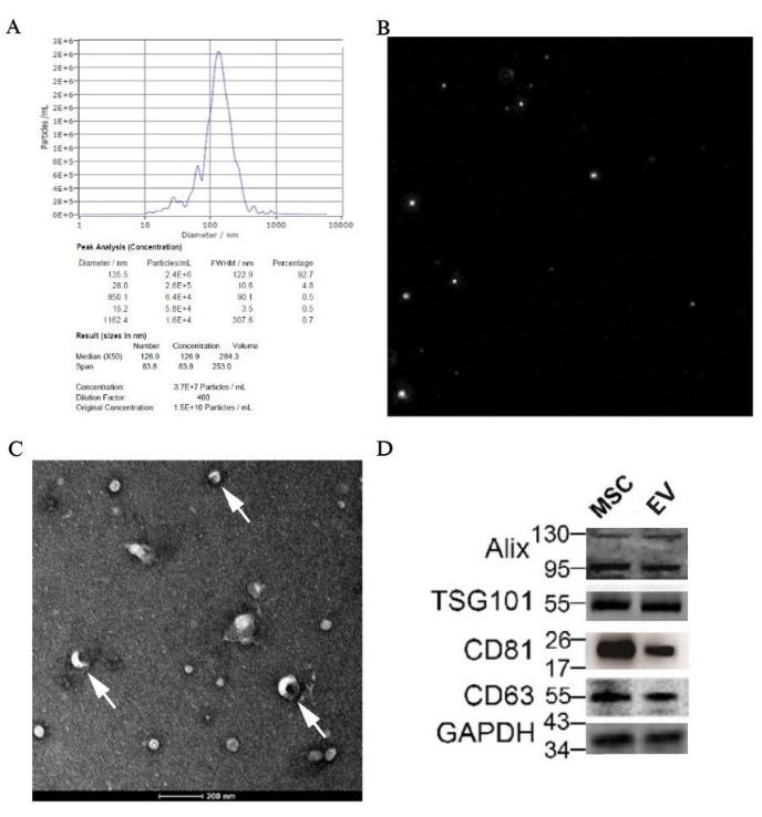 figure-results-7 NTA particle size distribution, NTA image, TEM visualization, western blot, vesicle characterization.