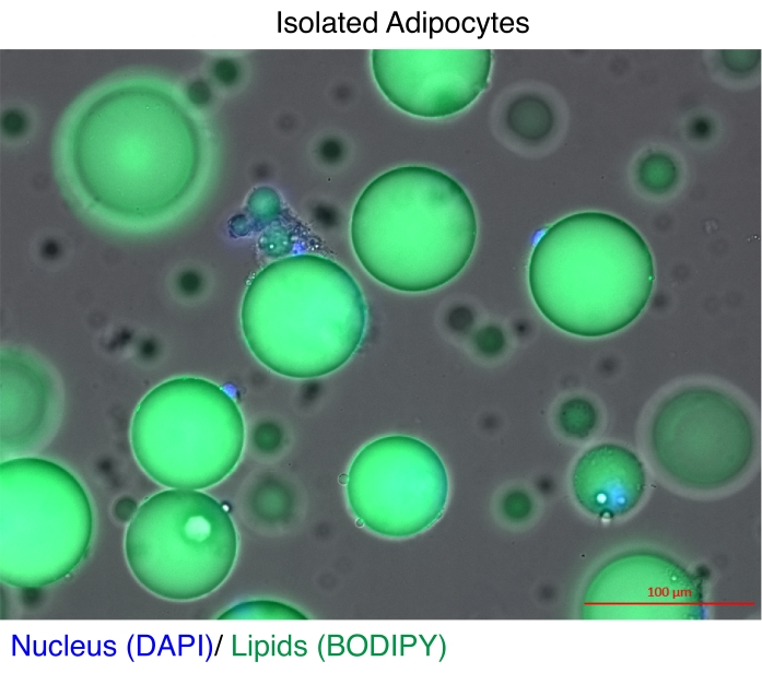figure-results-1 Adipocyte microscopy, nucleus (DAPI), lipids (BODIPY), fluorescence imaging analysis, cell study.