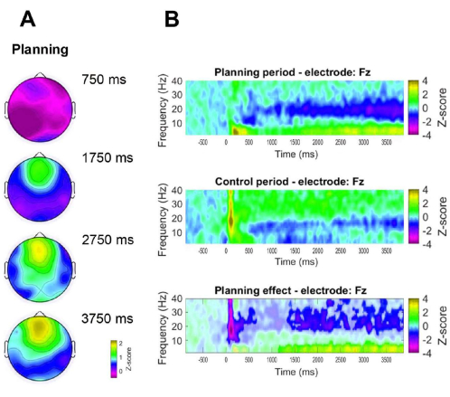 EEG topographic maps and time-frequency plots showing brain activity during planning.