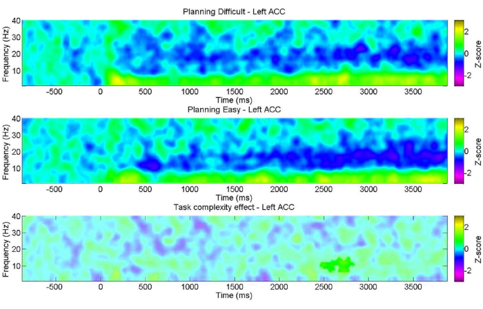 Frequency vs. Time plots for task complexity effect analysis, showing Z-score variations in Left ACC.