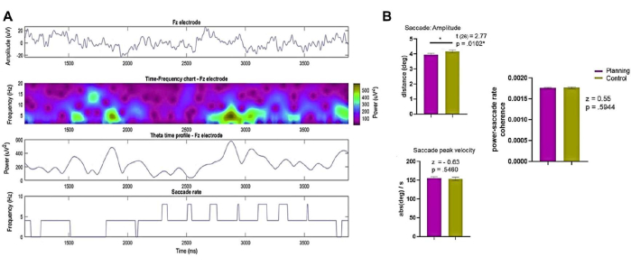 Fz electrode frequency analysis; time-frequency chart, theta profile, saccade amplitude, and velocity graphs.