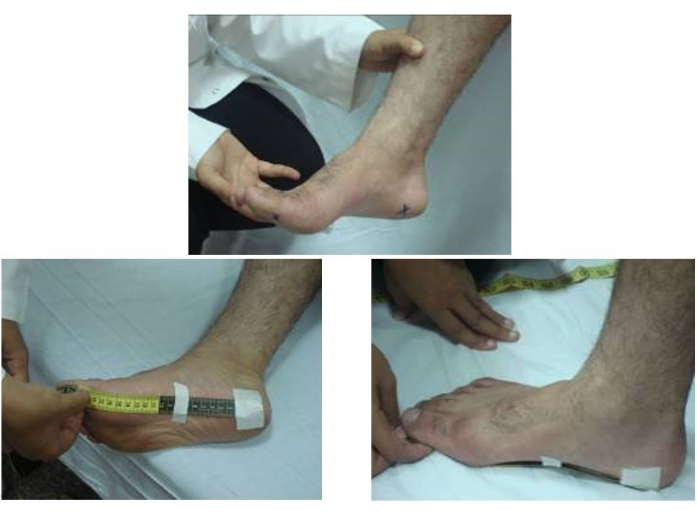 figure-results-1 Foot measurement for biometric study; includes tape measures and foot positioning analysis.