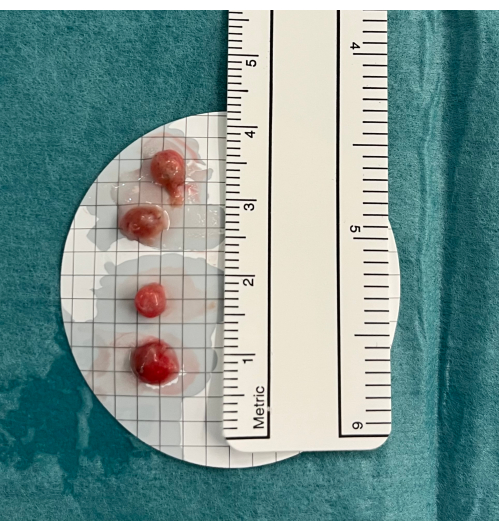 Tissue culture growth on petri dish with ruler; study of cell proliferation and measurement.