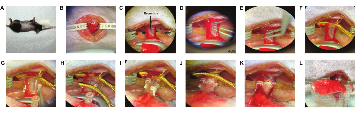 figure-results-3 Surgical procedure images showing rodent bronchus dissection and artery ligation; step-by-step guide.