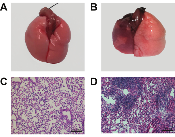figure-results-4 Lung tissue comparison, healthy vs diseased; histology examination; microscopic analysis results.