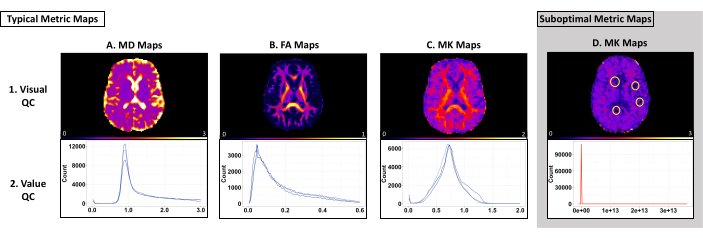 figure-results-4 Brain MRI metric maps: MD, FA, MK. Visual, quantitative QC with histograms, image quality analysis.