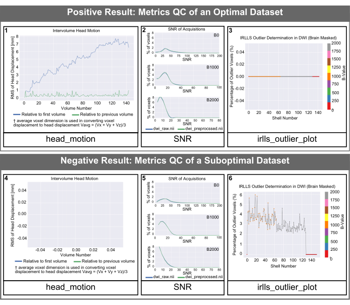 figure-results-5 QC metrics, signal-to-noise ratio, head motion graphs, IRLLS outlier plots, diffusion imaging.