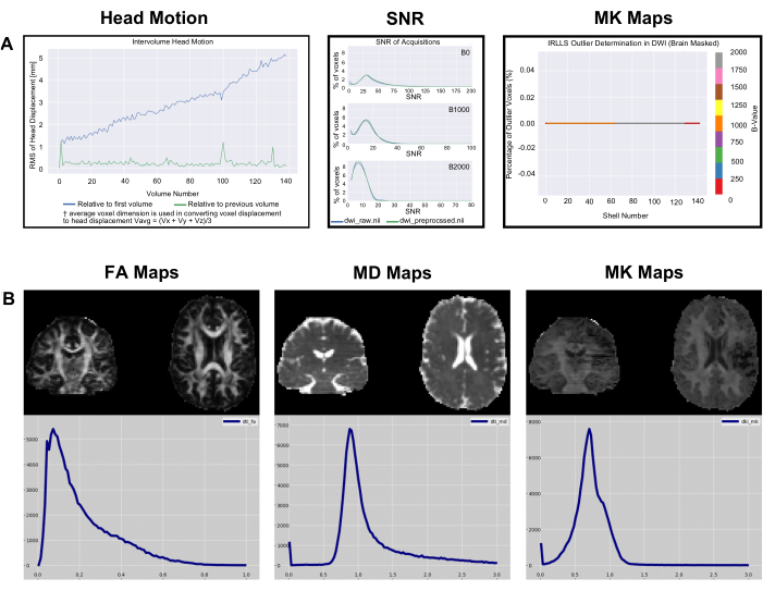 figure-results-6 Head motion analysis, SNR evaluation, MK maps; FA, MD, MK maps; MRI image data, diffusion study.