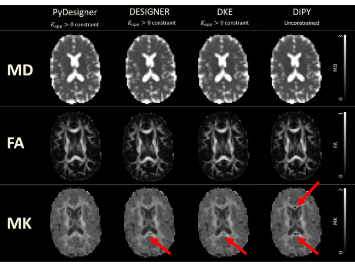 figure-results-7 Diffusion MRI brain images comparing MD, FA, MK maps under PyDesigner, DESIGNER, DKE, DIPY methods.