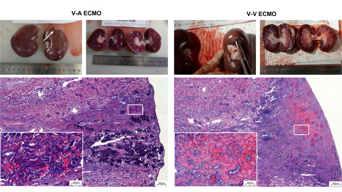Kidney pathology comparison under V-A and V-V ECMO showing tissue slices and histological analysis.