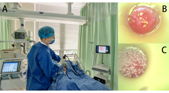figure-results-2 Medical endoscopy process; doctor using endoscope, images show tissue samples, endoscopic setup.