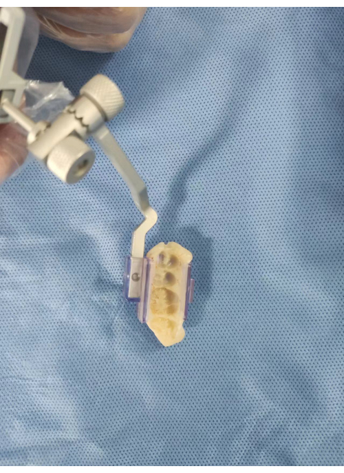 Dental impression process; mold replica and alignment tool on surgical tray.